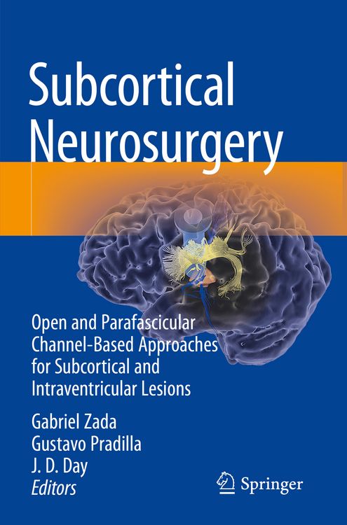 Produktbild: Subcortical Neurosurgery