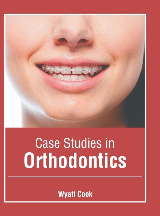 Produktbild: Case Studies in Orthodontics