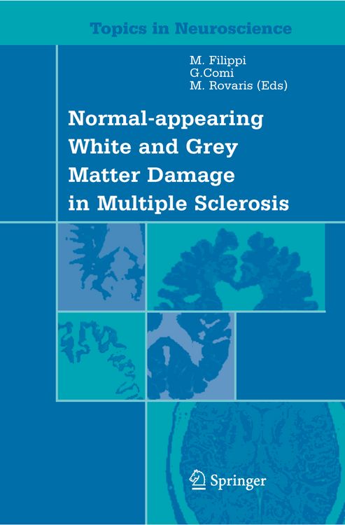 Produktbild: Normal-appearing White and Grey Matter Damage in Multiple Sclerosis