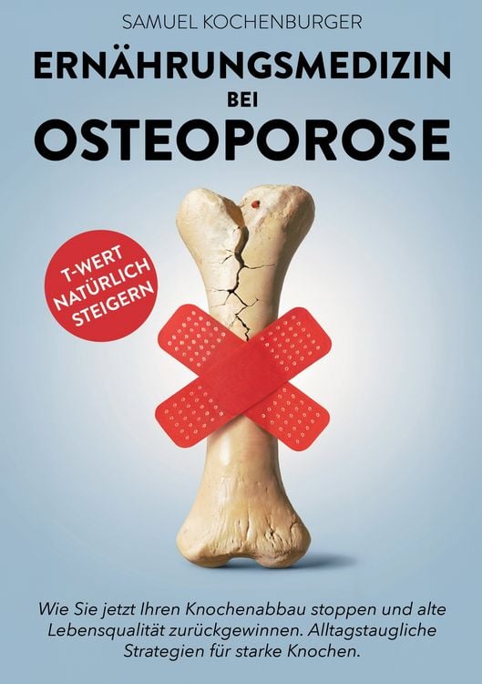 Produktbild: Ern&auml;hrungsmedizin bei Osteoporose