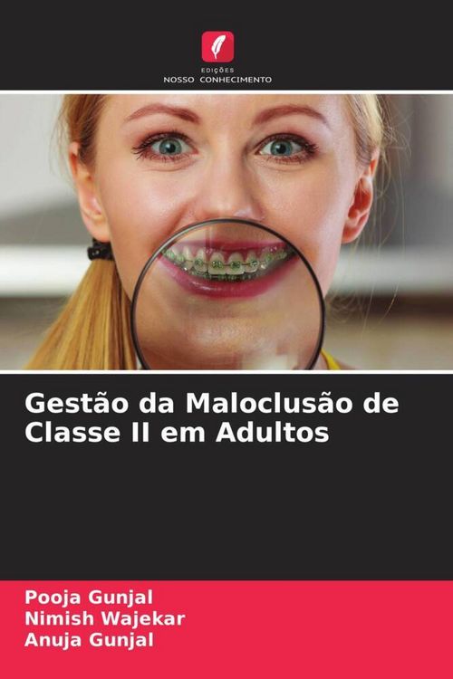Produktbild: Gest&atilde;o da Maloclus&atilde;o de Classe II em Adultos