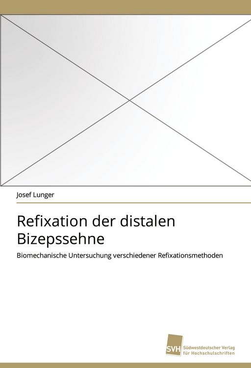 Produktbild: Refixation der distalen Bizepssehne