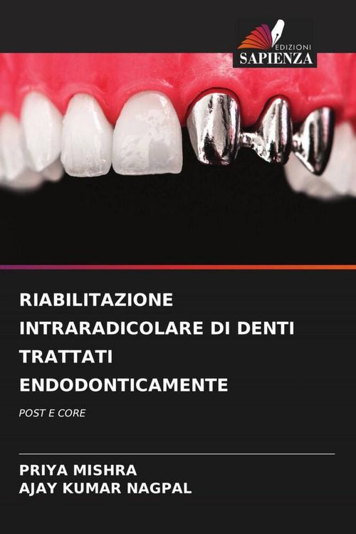 Produktbild: Riabilitazione Intraradicolare Di Denti Trattati Endodonticamente