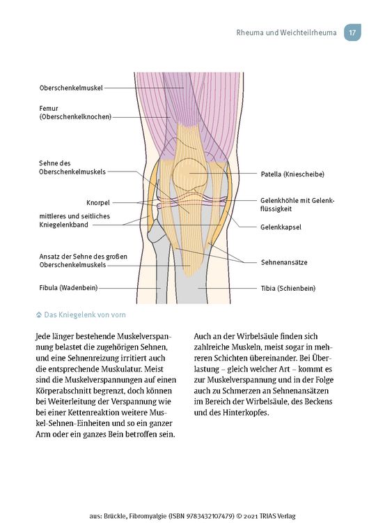 Produktbild: Fibromyalgie