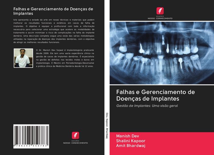 Produktbild: Falhas e Gerenciamento de Doen&ccedil;as de Implantes