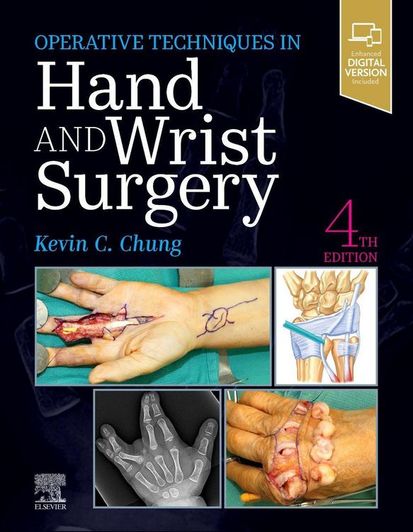 Produktbild: Operative Techniques: Hand and Wrist Surgery