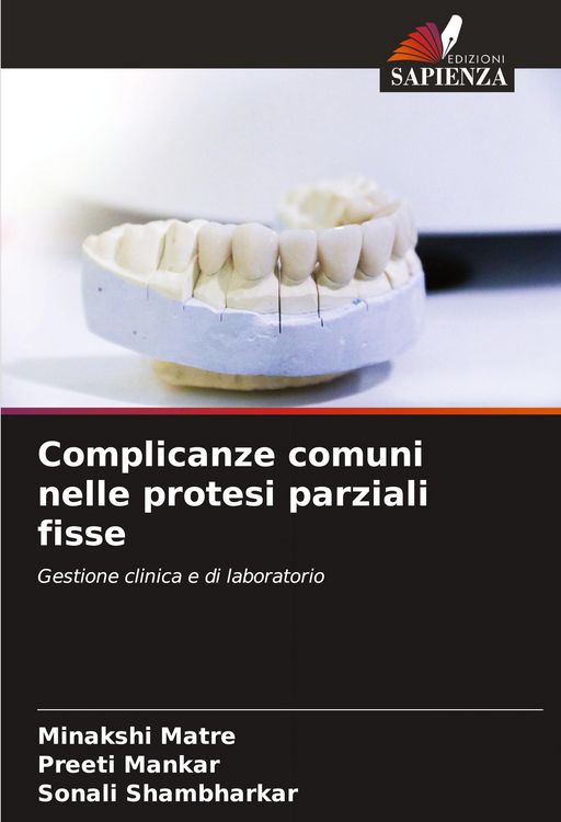 Produktbild: Complicanze comuni nelle protesi parziali fisse