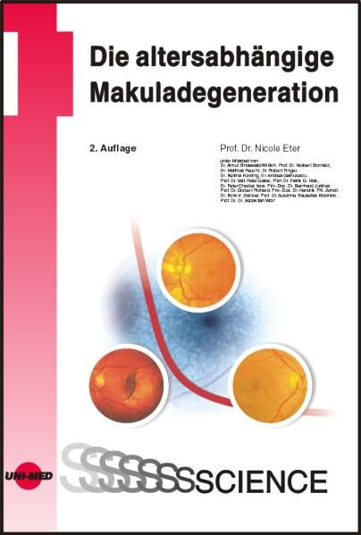 Produktbild: Die altersabh&auml;ngige Makuladegeneration