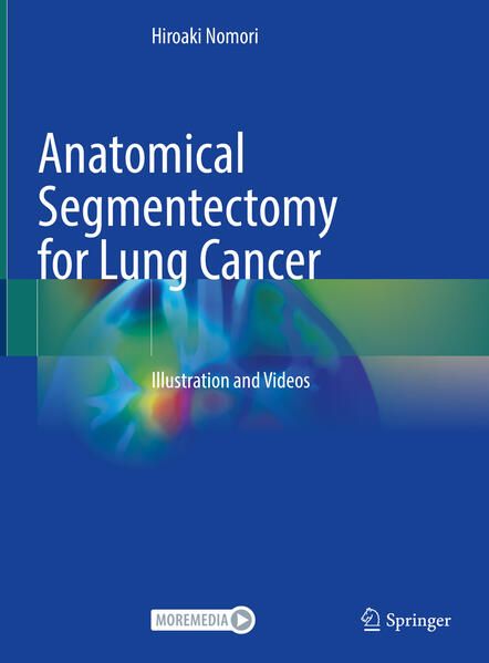 Produktbild: Anatomical Segmentectomy for Lung Cancer