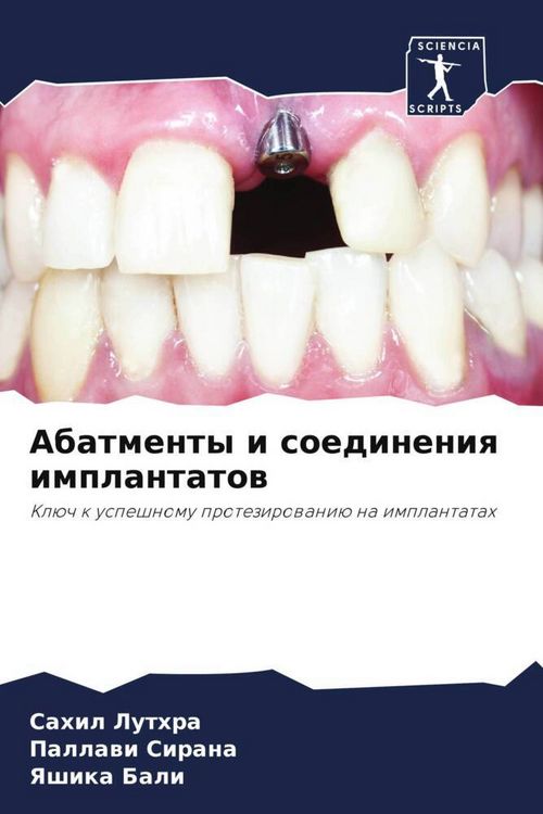 Produktbild: Abatmenty i soedineniq implantatow