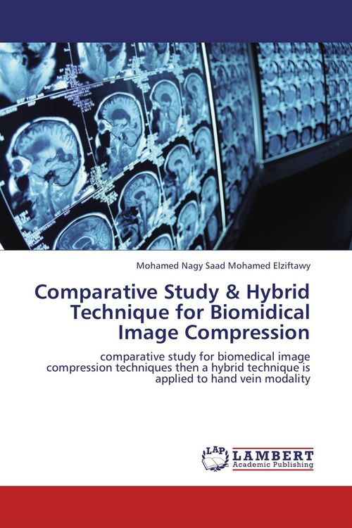 Produktbild: Comparative Study & Hybrid Technique for Biomidical Image Compression