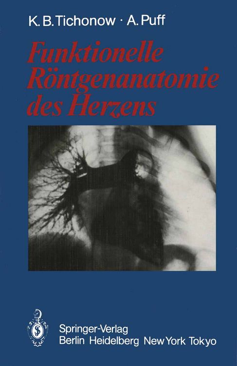 Produktbild: Funktionelle R&ouml;ntgenanatomie des Herzens