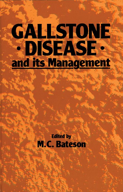 Produktbild: Gallstone Disease and its Management