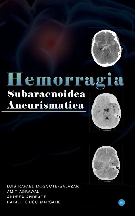 Produktbild: Hemorragia Subaracnoidea Aneurismatica