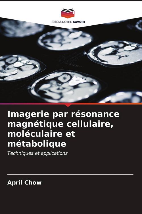 Produktbild: Imagerie par r&eacute;sonance magn&eacute;tique cellulaire, mol&eacute;culaire et m&eacute;tabolique