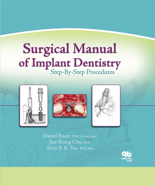 Produktbild: Surgical Manual of Implant Dentistry