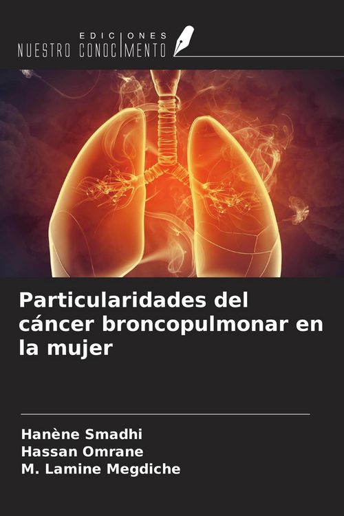 Produktbild: Particularidades del c&aacute;ncer broncopulmonar en la mujer