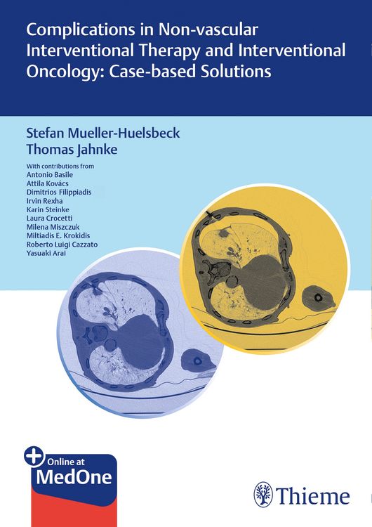 Produktbild: Complications in Non-vascular Interventional Therapy and Interventional Oncology: Case-based Solutions