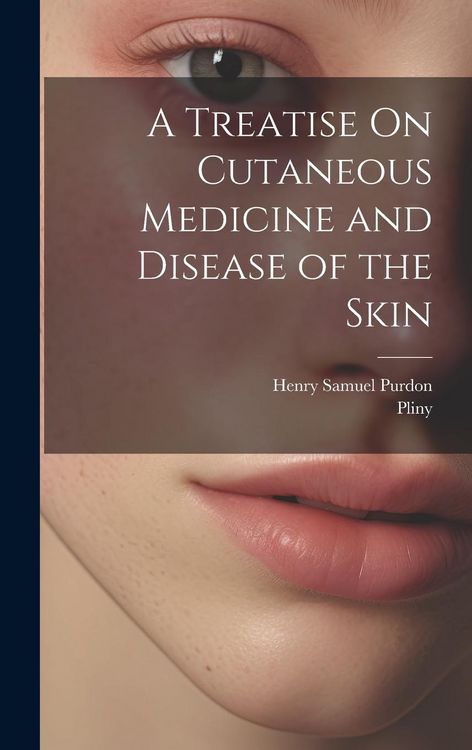 Produktbild: A Treatise On Cutaneous Medicine and Disease of the Skin