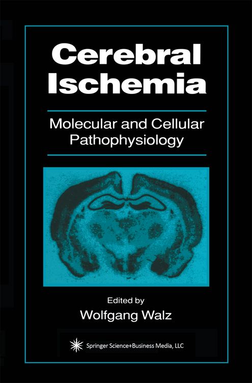 Produktbild: Cerebral Ischemia