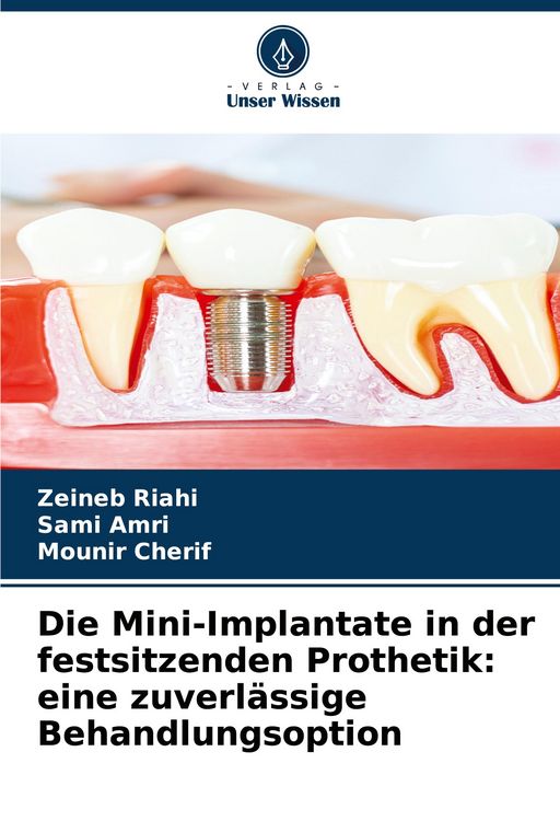Produktbild: Die Mini-Implantate in der festsitzenden Prothetik: eine zuverl&auml;ssige Behandlungsoption