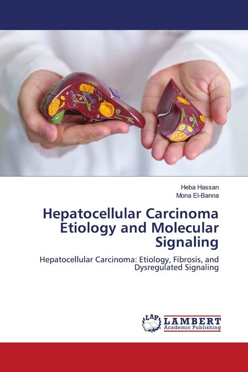 Produktbild: Hepatocellular Carcinoma Etiology and Molecular Signaling