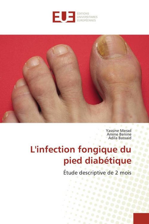 Produktbild: L'infection fongique du pied diab&eacute;tique