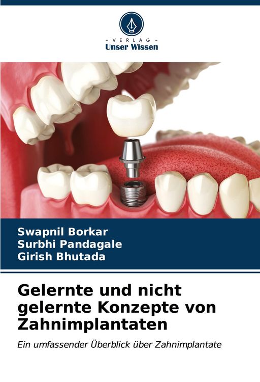 Produktbild: Gelernte und nicht gelernte Konzepte von Zahnimplantaten
