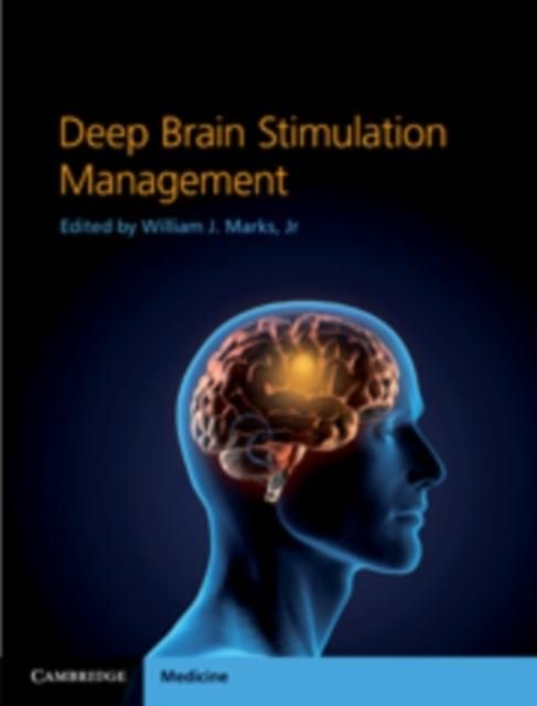 Produktbild: Deep Brain Stimulation Management