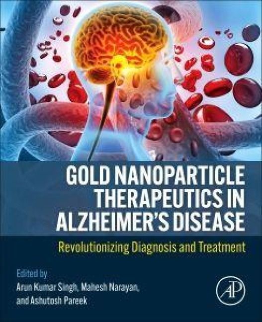 Produktbild: Gold Nanoparticle Therapeutics in Alzheimer's Disease
