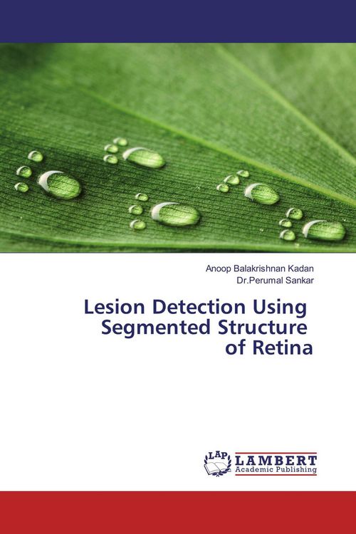 Produktbild: Lesion Detection Using Segmented Structure of Retina