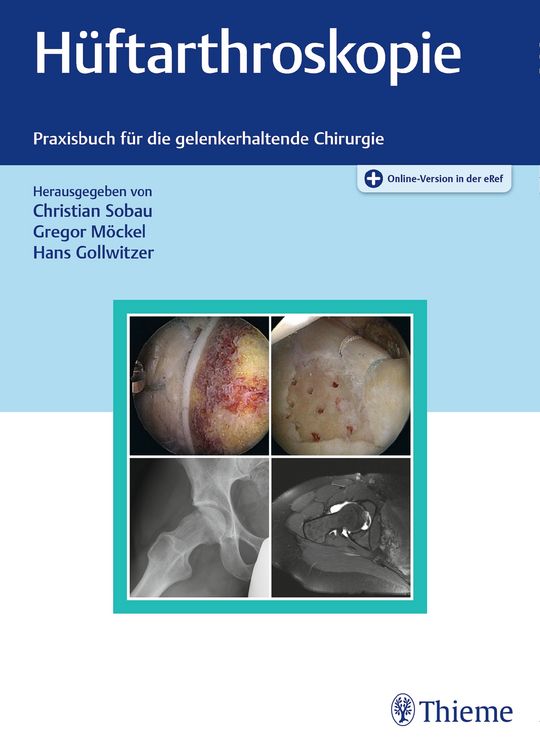 Produktbild: H&uuml;ftarthroskopie