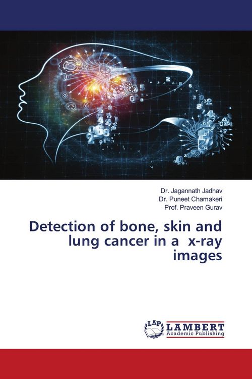Produktbild: Detection of bone, skin and lung cancer in a x-ray images