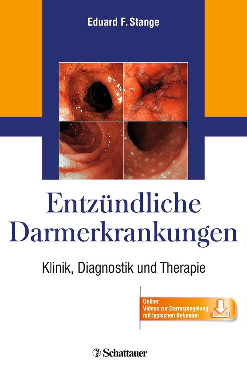 Produktbild: Entz&uuml;ndliche Darmerkrankungen