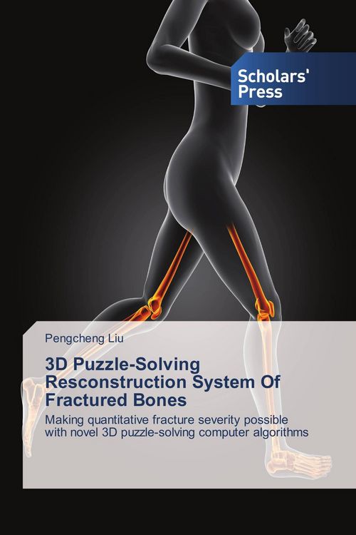 Produktbild: 3D Puzzle-Solving Resconstruction System Of Fractured Bones