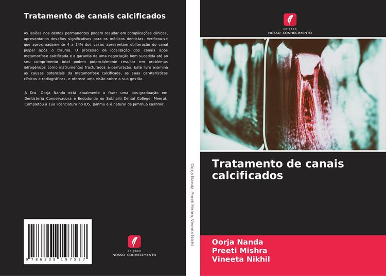Produktbild: Tratamento de canais calcificados