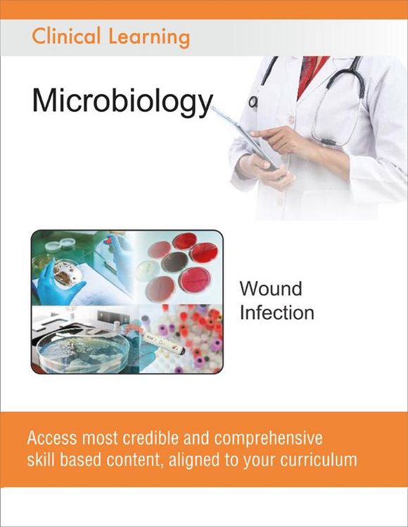 Produktbild: Wound Infection