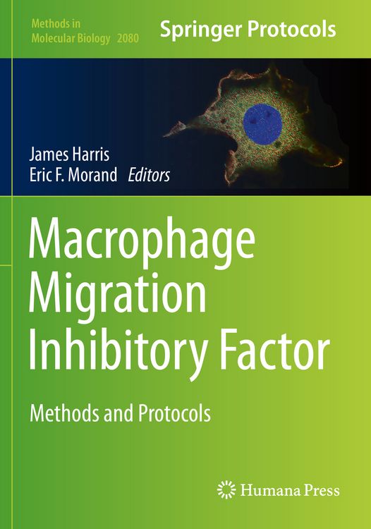 Produktbild: Macrophage Migration Inhibitory Factor