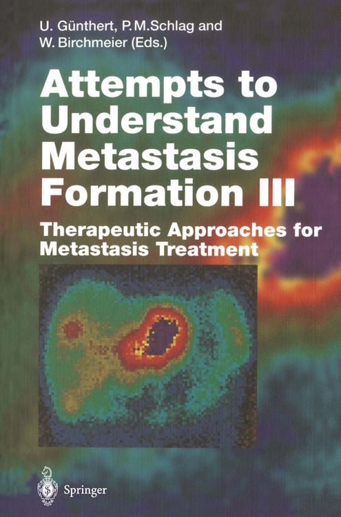 Produktbild: Attempts to Understand Metastasis Formation III
