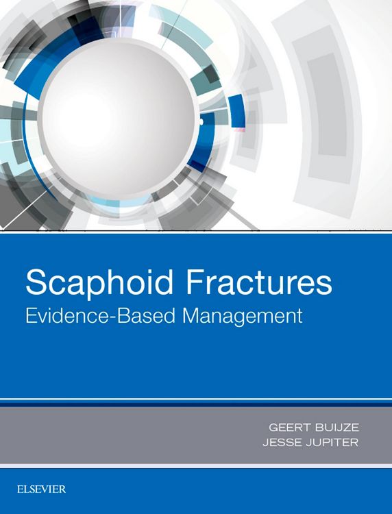 Produktbild: Scaphoid Fractures