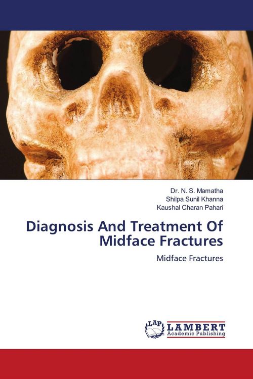 Produktbild: Diagnosis And Treatment Of Midface Fractures