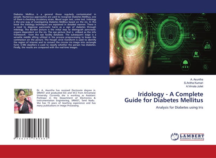 Produktbild: Iridology - A Complete Guide for Diabetes Mellitus