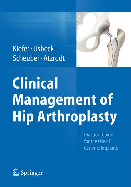 Produktbild: Clinical Management of Hip Arthroplasty
