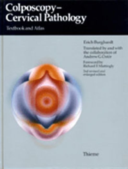 Produktbild: Colposcopy, Cervical Pathology