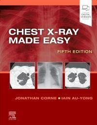 Produktbild: Chest X-Ray Made Easy