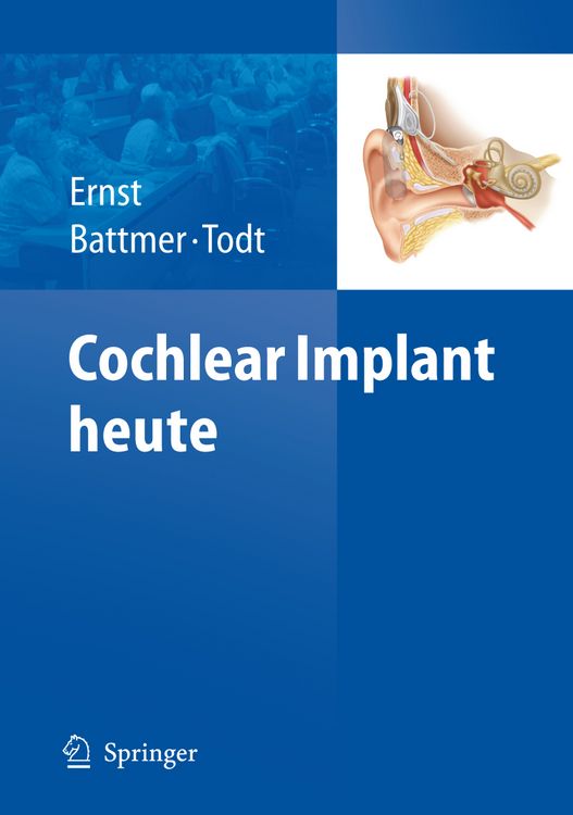 Produktbild: Cochlear Implant heute