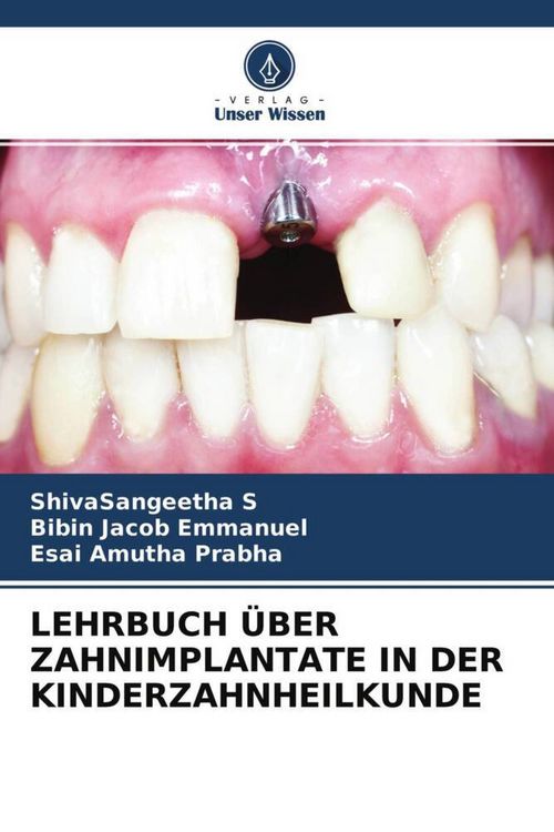 Produktbild: Lehrbuch &uuml;ber Zahnimplantate in der Kinderzahnheilkunde