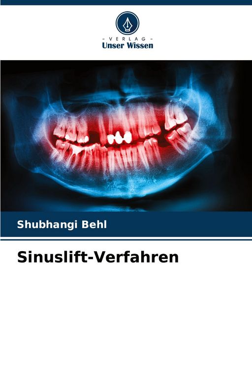 Produktbild: Sinuslift-Verfahren