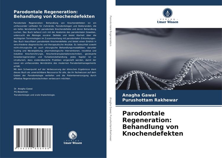 Produktbild: Parodontale Regeneration: Behandlung von Knochendefekten