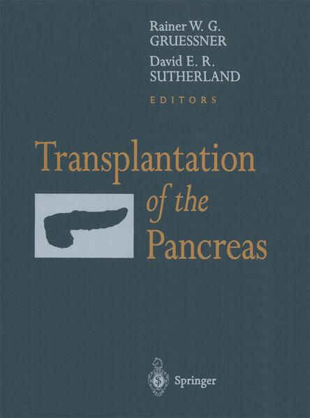 Produktbild: Transplantation of the Pancreas